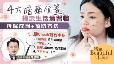 下巴 瘡|【暗瘡位置】不同代表什麼？中醫教如何處理及預防